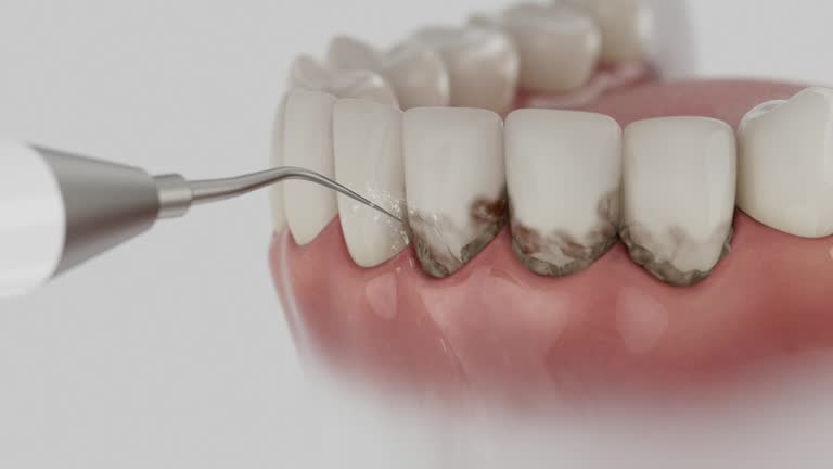 Trusted Invisalign Clear Aligners service in Des Allemands, LA - Dentist Open Now